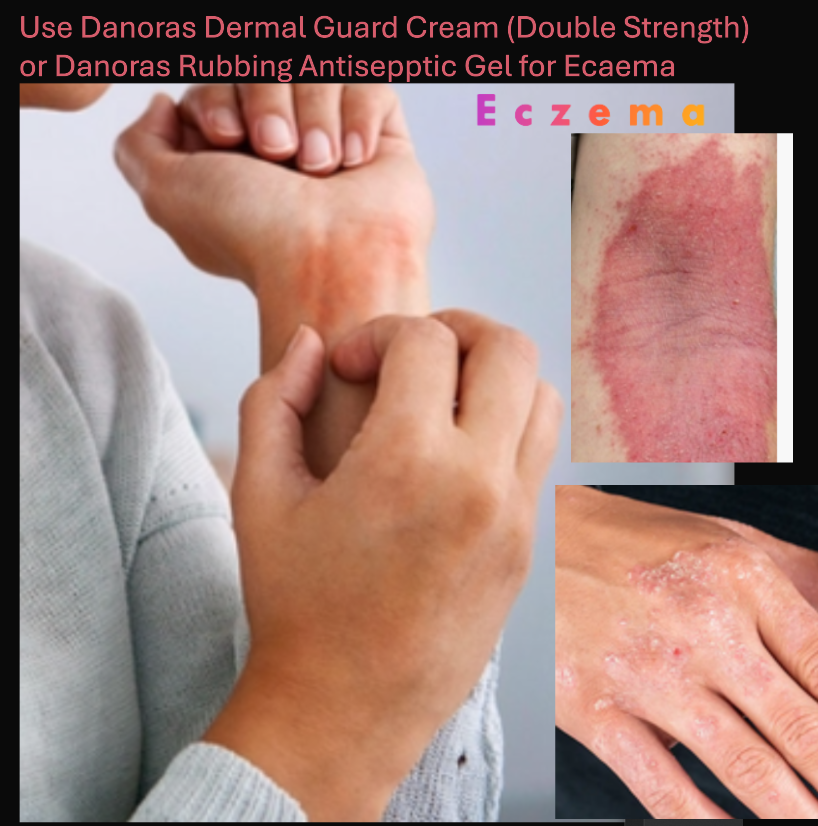 Danoras Rubbing Antiseptic Gel L300-1oz