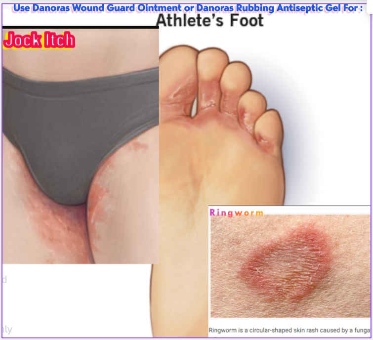 Danoras Rubbing Antiseptic Gel L300-1oz