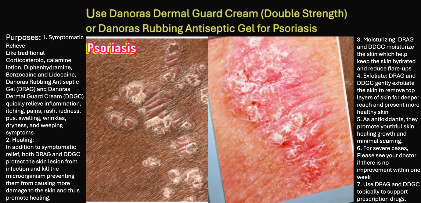Danoras Rubbing Antiseptic Gel L300-1oz